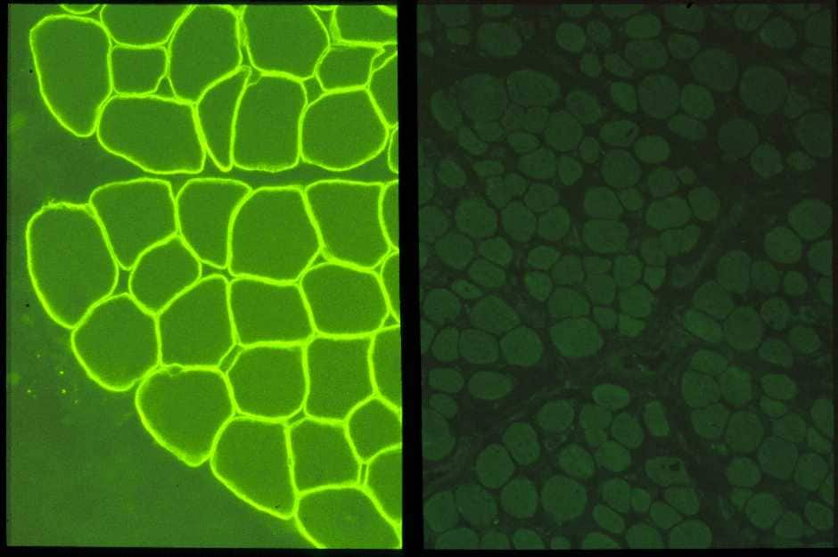 図７:ジストロフィン抗体による免疫染色