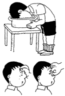 目の異物