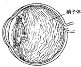 硝子しょうし体