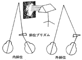 斜視