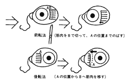 斜視