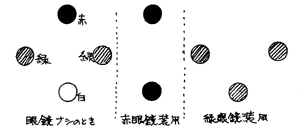 斜視