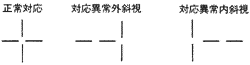 斜視